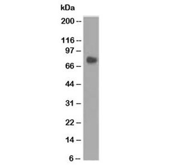 CEA Antibody / Carcinoembryonic Antigen
