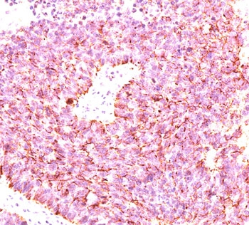Chromogranin A Antibody Cocktail