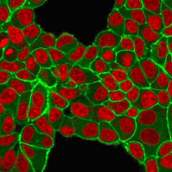 HER2 Antibody / ErbB2