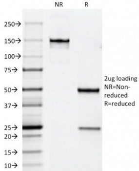 HER2 Antibody / ErbB2