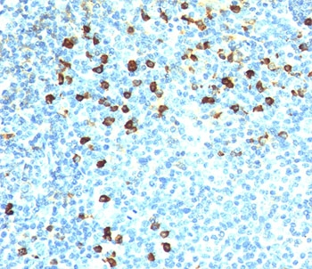 Kappa Light Chain Antibody
