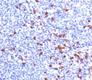 Kappa Light Chain Antibody