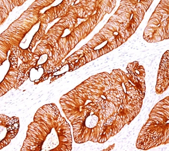 KRT8 Antibody / Cytokeratin 8