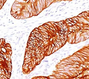 KRT8 Antibody Cocktail / Cytokeratin 8