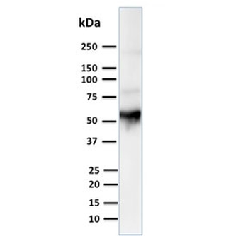 KRT10 Antibody / Cytokeratin 10