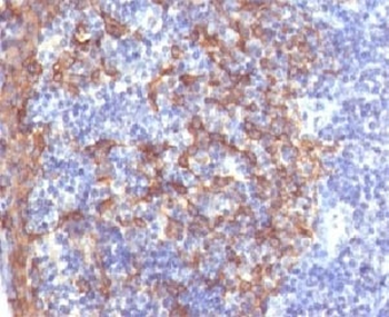 Cytokeratin 14 Antibody / CK14 / KRT14