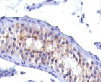 Prolactin Receptor Antibody / PRLR