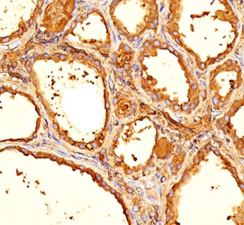 TG Antibody / Thyroglobulin