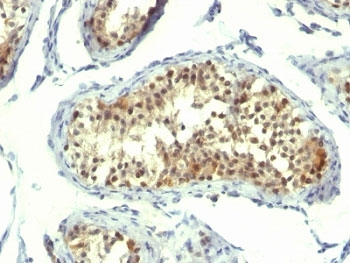 Thymidylate Synthase Antibody