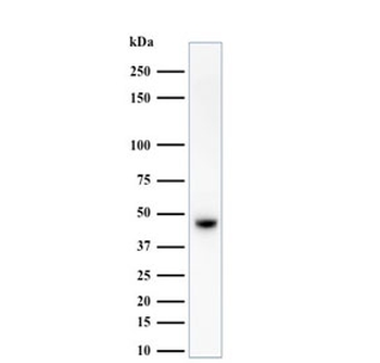 Basic Cytokeratin Antibody (HMW / Type II)