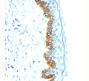 Acidic Cytokeratin Antibody (LMW / Type I)