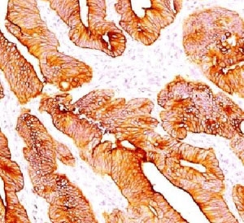 Cytokeratin Antibody, Multi 4/5/6/8/10/13/18