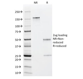 EBV Early Antigens Antibody