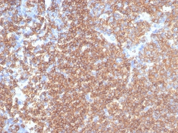 Recombinant CD45RA Antibody (Leukocyte marker)