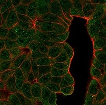 B-cell lymphoma/leukemia 11A Antibody / BCL11A