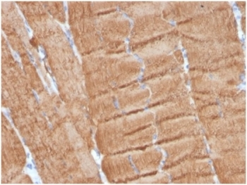 Actin alpha 1 Antibody / ACTA1
