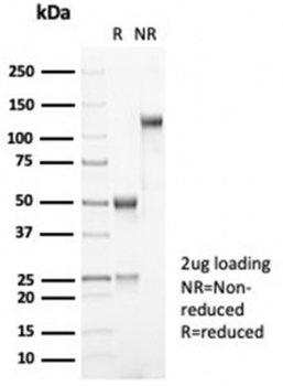 Recombinant MDM2 Antibody