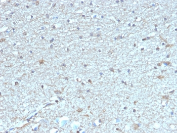 LEPR Antibody / Leptin Receptor / Ob-R