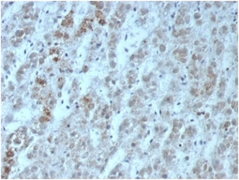Recombinant Interleukin 15 Antibody / IL15