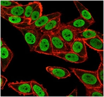 Chk2 Antibody / CHEK2