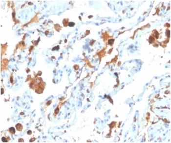 Surfactant protein D Antibody / SFTPD