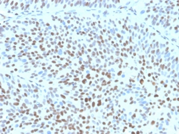 Recombinant p27Kip1 Antibody / p27 / CDKN1B