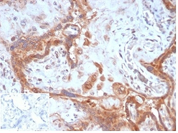 Fibroblast Activation Protein Alpha Antibody / FAP