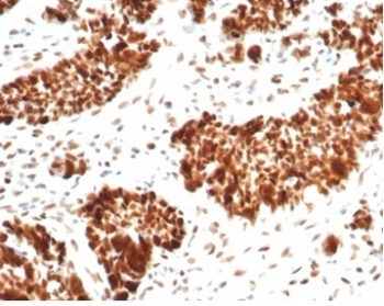 Recombinant MSH6 Antibody