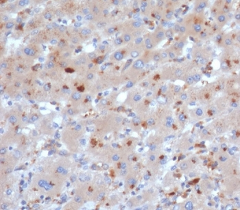 SERPINA3 Antibody / AACT / Alpha-1-Antichymotrypsin