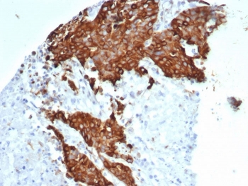 Recombinant Beta Tubulin Antibody / TUBB3