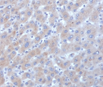 Alpha-1-Antichymotrypsin Antibody / AACT / SERPINA3