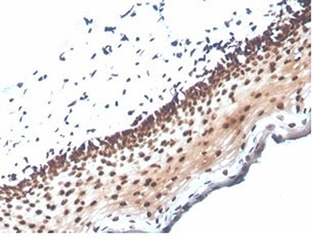 NME1 Antibody / NM23