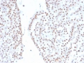 Recombinant SF-1 Antibody / Steroidogenic Factor 1 / NR5A1