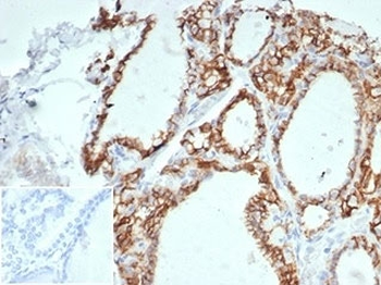 Recombinant Cadherin 16 Antibody / CDH16