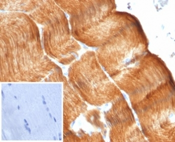 Recombinant Sarcomeric Alpha Actinin Antibody / Alpha Actinin 2 / ACTN2