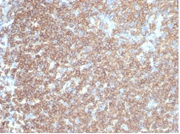 Recombinant CD45RA Antibody (Leukocyte marker)