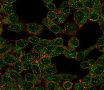 CHRAC17 Antibody / POLE3