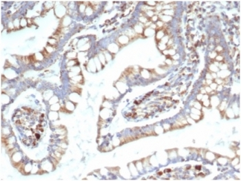 TREM2 Antibody