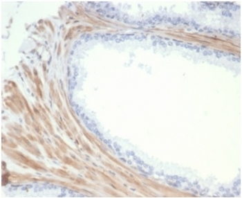 Recombinant Aciculin Antibody / Phosphoglucomutase 5 / PGM5