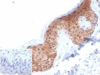 SERPINB5 Antibody / MASPIN