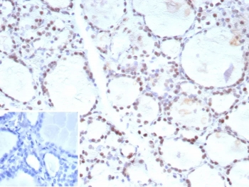 FOXP1 Antibody
