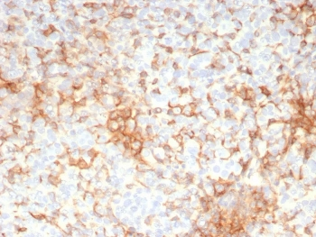 Adipophilin Antibody / Perilipin 2 / ADRP / PLIN2