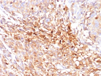 MRP8 Antibody / ABCC11