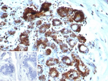 BAP1 Antibody / BRCA1-Associated Protein 1