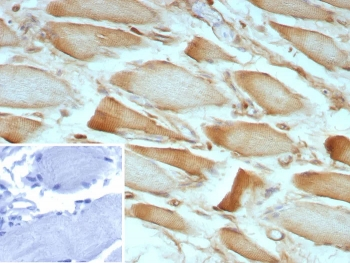 ZNF804A Antibody / Zinc finger protein 804A