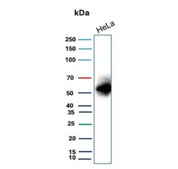 CA9 Antibody / Carbonic Anhydrase IX