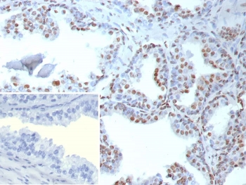 TDP43 Antibody / TARDBP / TAR DNA binding protein
