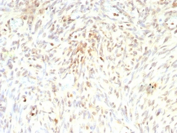 MDM2 Antibody