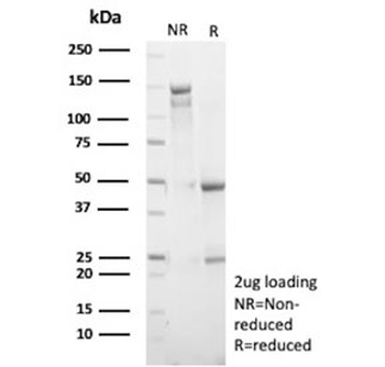 Ki-67 Antibody