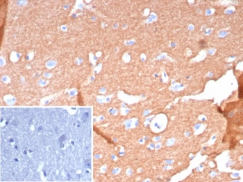 L1CAM Antibody / NCAM-L1 / CD171
